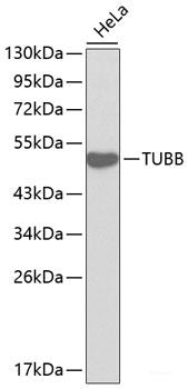 Western blot analysis of extracts of Rat liver using RBP1 Polyclonal Antibody at dilution of 1:1000.