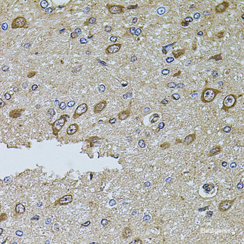 Immunofluorescence analysis of C6 cells using GTF3C4 Polyclonal Antibody at dilution of 1:100 (40x lens). Blue: DAPI for nuclear staining.