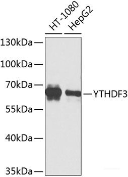 Western blot analysis of extracts of various cell lines using ARPC5 Polyclonal Antibody at dilution of 1:1000.