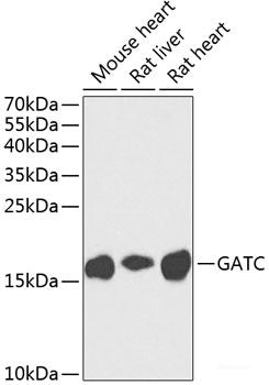 Immunohistochemistry of paraffin-embedded Human prostate using PLA2G7 Polyclonal Antibody at dilution of 1:100 (40x lens).