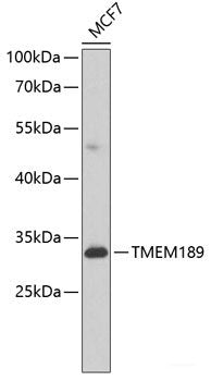 Immunofluorescence analysis of C6 cells using TRPV1 Polyclonal Antibody at dilution of 1:100. Blue: DAPI for nuclear staining.
