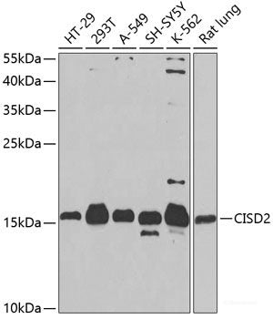 Western blot analysis of extracts of Mouse liver using ADH4 Polyclonal Antibody at dilution of 1:1000.