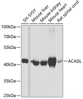 Immunofluorescence analysis of U2OS cells using CDK7 Polyclonal Antibody