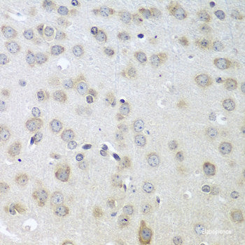 Western blot analysis of extracts of Mouse spleen using PTHLH Polyclonal Antibody.