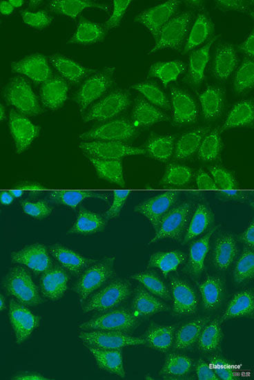 Immunohistochemistry of paraffin-embedded Human esophagus using CNOT8 Polyclonal Antibody at dilution of 1:100 (40x lens).