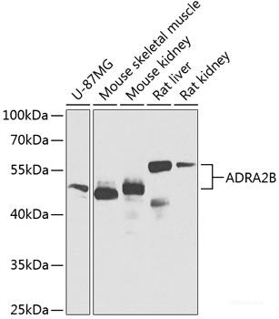 Western blot analysis of extracts of A-549 cells using FBXW5 Polyclonal Antibody at dilution of 1:1000.