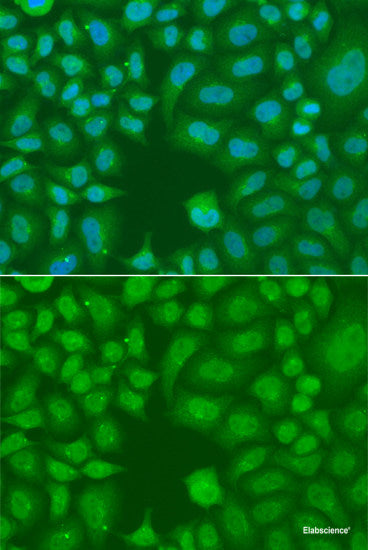 Immunohistochemistry of paraffin-embedded Human kidney using ARNT2 Polyclonal Antibody at dilution of 1:100 (40x lens).