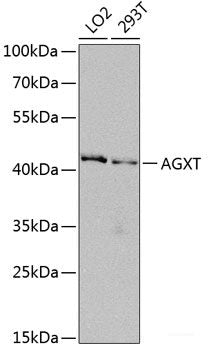 Western blot analysis of extracts of various cell lines using GPHN Polyclonal Antibody at dilution of 1:1000.