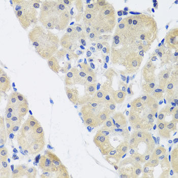 Immunohistochemistry of paraffin-embedded Human prostate using CYP46A1 Polyclonal Antibody at dilution of 1:100 (40x lens).