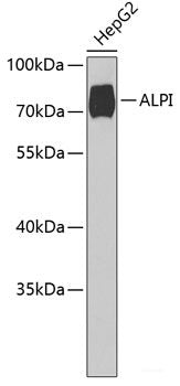 Western blot analysis of extracts of various cell lines using TPP2 Polyclonal Antibody at dilution of 1:1000.