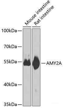 Immunohistochemistry of paraffin-embedded Human colon using CCDC92 Polyclonal Antibody at dilution of 1:100 (40x lens).