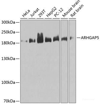 Western blot analysis of extracts of HepG2 cells using CDS2 Polyclonal Antibody.