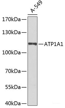 Western blot analysis of extracts of Mouse liver using TRMT61B Polyclonal Antibody at dilution of 1:1000.