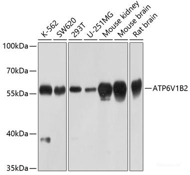 Immunohistochemistry of paraffin-embedded Rat brain using SAP18 Polyclonal Antibody at dilution of 1:100 (40x lens).