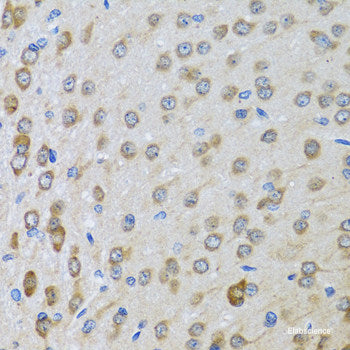 Immunohistochemistry of paraffin-embedded Human breast using SEPHS1 Polyclonal Antibody at dilution of 1:100 (40x lens).
