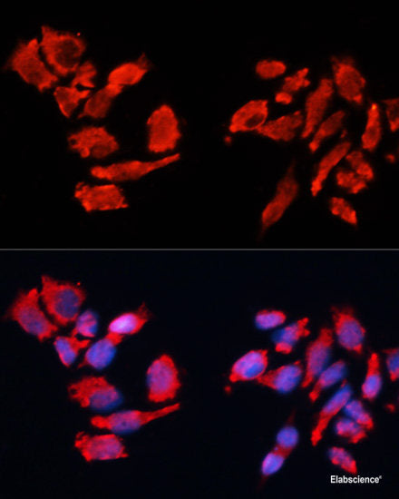 Immunofluorescence analysis of C6 cells using SMAD2 Polyclonal Antibody at dilution of 1:100. Blue: DAPI for nuclear staining.