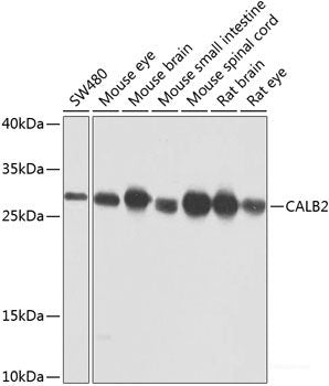 Immunofluorescence analysis of U2OS cells using Phospho-MET(Y1349) Polyclonal Antibody