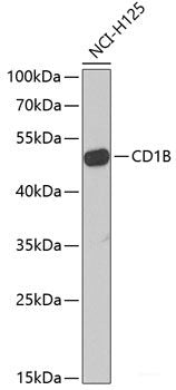 Immunohistochemistry of paraffin-embedded Human liver damage using RBP2 Polyclonal Antibody at dilution of 1:100 (40x lens).