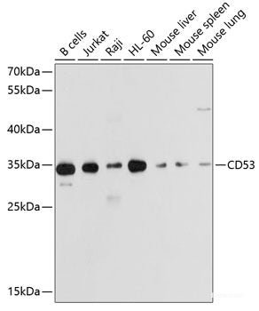 Western blot analysis of extracts of various cell lines using KREMEN1 Polyclonal Antibody at dilution of 1:1000.