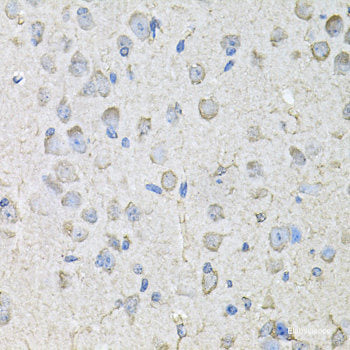 Immunohistochemistry of paraffin-embedded Human liver damage using EIF3M Polyclonal Antibody at dilution of 1:100 (40x lens).