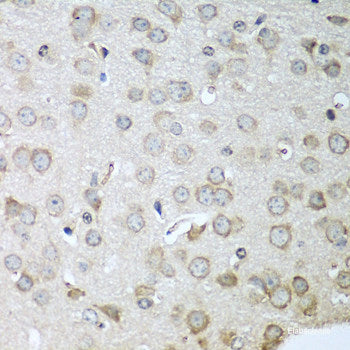 Immunohistochemistry of paraffin-embedded Mouse stomach using AP1M2 Polyclonal Antibody at dilution of 1:100 (40x lens).