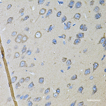 Western blot analysis of extracts of HepG2 cells using HSD11B2 Polyclonal Antibody at dilution of 1:1000.