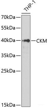 Western blot analysis of extracts of various cell lines using KRT17 Polyclonal Antibody at dilution of 1:1000.