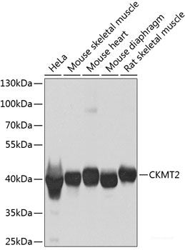 Immunofluorescence analysis of C6 cells using BFAR Polyclonal Antibody at dilution of 1:100 (40x lens). Blue: DAPI for nuclear staining.