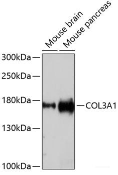 Western blot analysis of extracts of various cell lines using CCT8 Polyclonal Antibody at dilution of 1:7000.