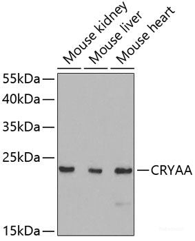 Immunofluorescence analysis of C6 cells using RPL17 Polyclonal Antibody at dilution of 1:100. Blue: DAPI for nuclear staining.