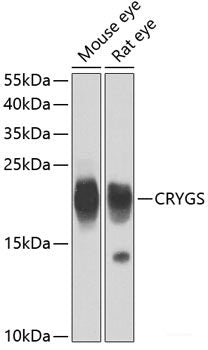 Immunofluorescence analysis of HeLa cells using CPS1 Polyclonal Antibody at dilution of 1:100 (40x lens). Blue: DAPI for nuclear staining.