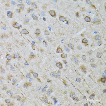 Immunohistochemistry of paraffin-embedded Mouse lung using TOMM34 Polyclonal Antibody at dilution of 1:100 (40x lens).