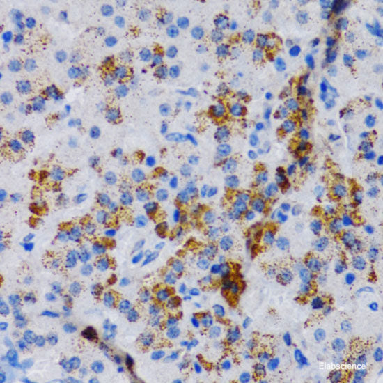 Immunohistochemistry of paraffin-embedded Rat spleen using CD27 Polyclonal Antibody at dilution of 1:100 (40x lens).