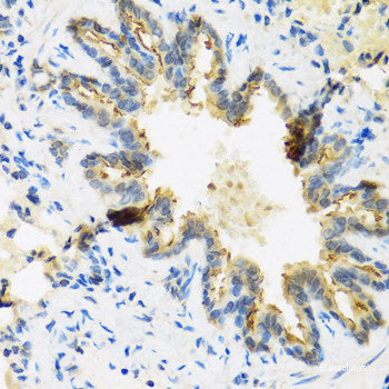 Immunofluorescence analysis of HeLa cells using MAPK1/MAPK3 Polyclonal Antibody at dilution of 1:100 (40x lens). Blue: DAPI for nuclear staining.