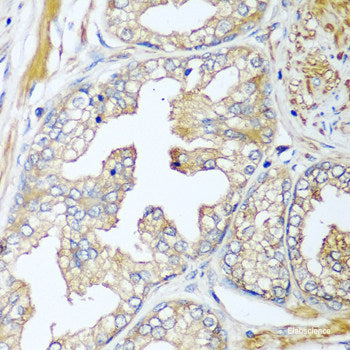 Immunohistochemistry of paraffin-embedded Human esophagus using KPNA3 Polyclonal Antibody at dilution of 1:100 (40x lens).