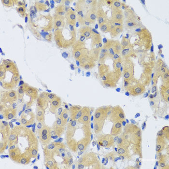 Immunohistochemistry of paraffin-embedded Human esophagus using PHB2 Polyclonal Antibody at dilution of 1:100 (40x lens).