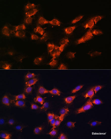 Western blot analysis of extracts of HL-60 cells using LPAR2 Polyclonal Antibody at dilution of 1:1000.