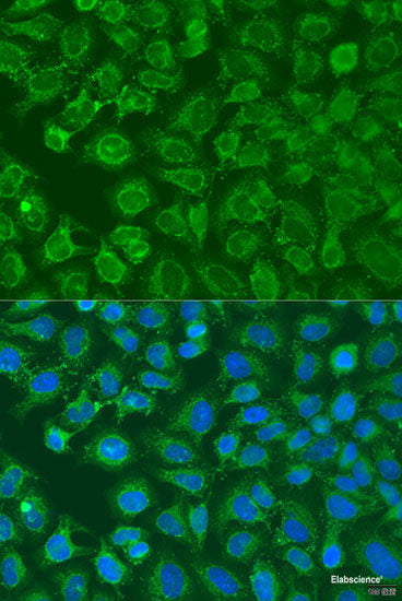 Immunofluorescence analysis of HeLa cells using MonoMethyl-NONO-R357/R365 Polyclonal Antibody at dilution of 1:100 (40x lens). Blue: DAPI for nuclear staining.