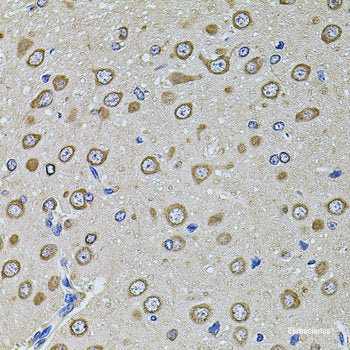 Immunohistochemistry of paraffin-embedded Human prostate using NLGN4Y Polyclonal Antibody at dilution of 1:100 (40x lens).