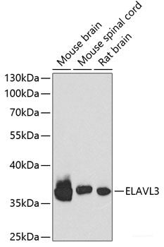 Immunofluorescence analysis of U2OS cells using FAP Polyclonal Antibody at dilution of 1:100. Blue: DAPI for nuclear staining.