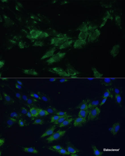 Western blot analysis of extracts of various cell lines using CGB7 Polyclonal Antibody at dilution of 1:1000.