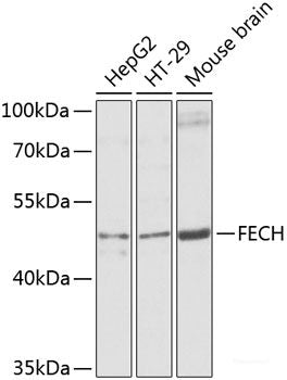 Western blot analysis of extracts of various cell lines using ADRB3 Polyclonal Antibody at dilution of 1:1000.