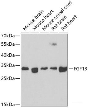 Immunohistochemistry of paraffin-embedded Human colon using CAV3 Polyclonal Antibody at dilution of 1:200 (40x lens).