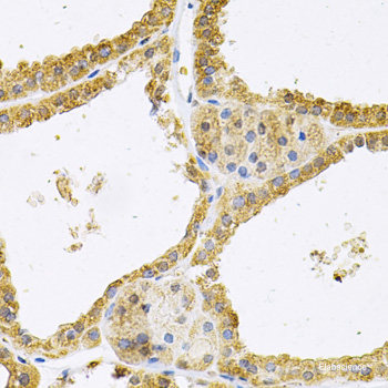 Immunohistochemistry of paraffin-embedded Human prostate using LEP Polyclonal Antibody at dilution of 1:100 (40x lens).