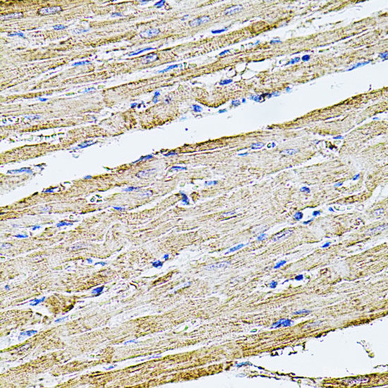 Western blot analysis of extracts of various cell lines using IGF2BP2 Polyclonal Antibody at dilution of 1:1000.
