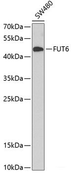 Immunofluorescence analysis of U-2 OS cells using ADNP Polyclonal Antibody at dilution of 1:100 (40x lens). Blue: DAPI for nuclear staining.