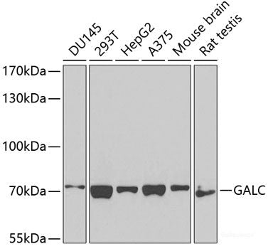 Western blot analysis of extracts of various cell lines using COTL1 Polyclonal Antibody at dilution of 1:1000.