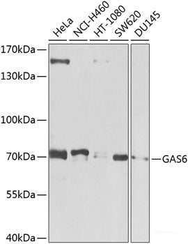 Western blot analysis of extracts of various cell lines using SLC34A2 Polyclonal Antibody at dilution of 1:3000.