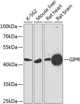 Immunohistochemistry of paraffin-embedded Rat lung using Phospho-MYC(S62) Polyclonal Antibody at dilution of 1:100 (40x lens).