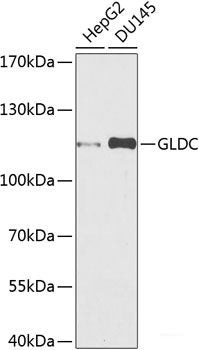 Western blot analysis of extracts from HL60 cells using Phospho-NFKB1(S927) Polyclonal Antibody.